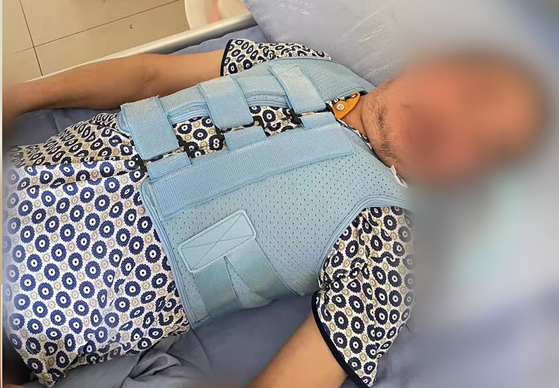 四川資陽骨科醫院 胸腰椎固定支具