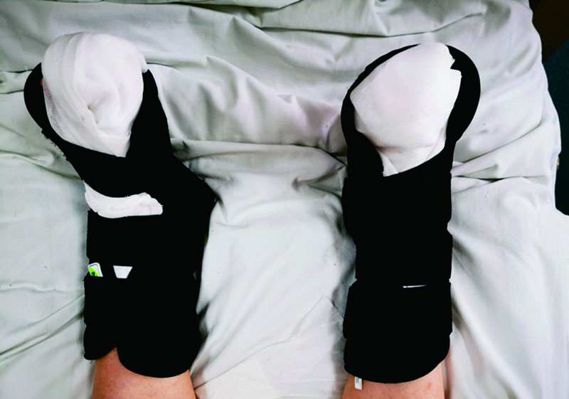 曲靖市第一人民醫院-足踝固定支具